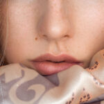 ほくろの位置が金運に影響するってホント？宝くじ当選の秘密！